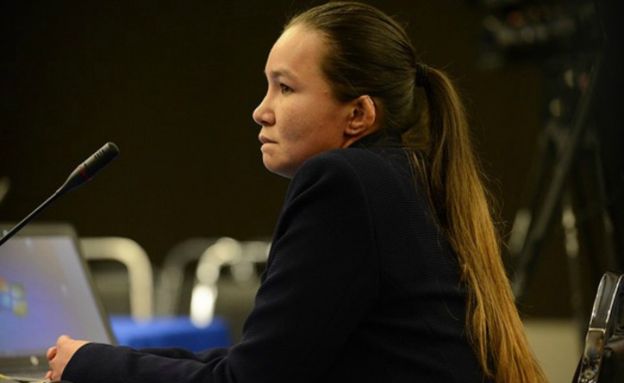 Linda Loaiza fue sometida a 15 cirugías como producto de los maltratos que recibió. (Foto cortesía de CEJIL)