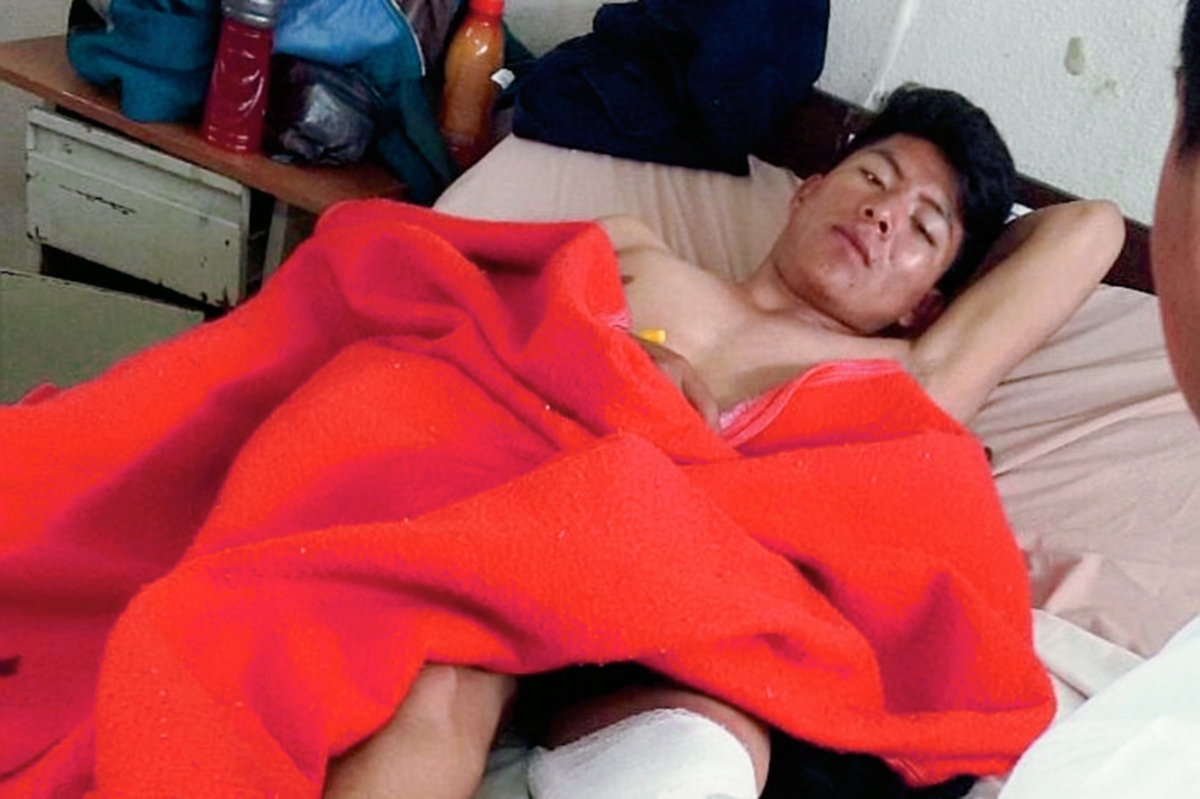 Yonathan Wilman Verriondo Noriega se recupera en un hospital. (Foto Prensa Libre: Óscar Figueroa)