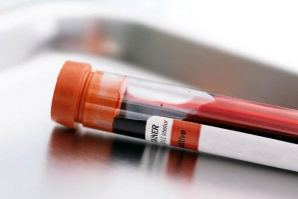 Mediante análisis de sangre se detectan biomarcadores que causan depresión.