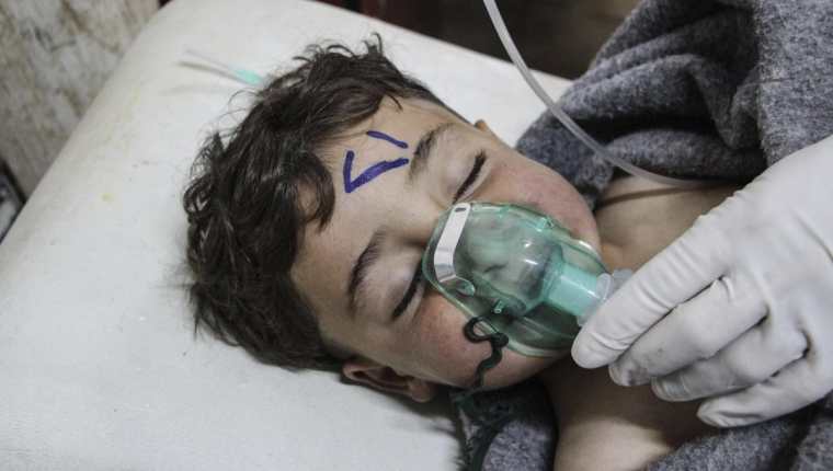 Un niño sirio recibe atención tras el supuesto ataque con armas químicas. (Foto Prensa Libre: EFE)