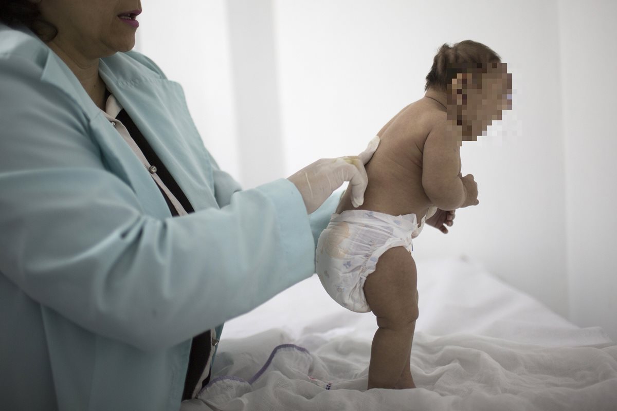 Autoridades de salud estadounidenses informaran que no hay dudas de que el virus del zika causa el nacimiento de bebés con cabezas anormalmente pequeñas. (Foto Prensa Libre: AFP).