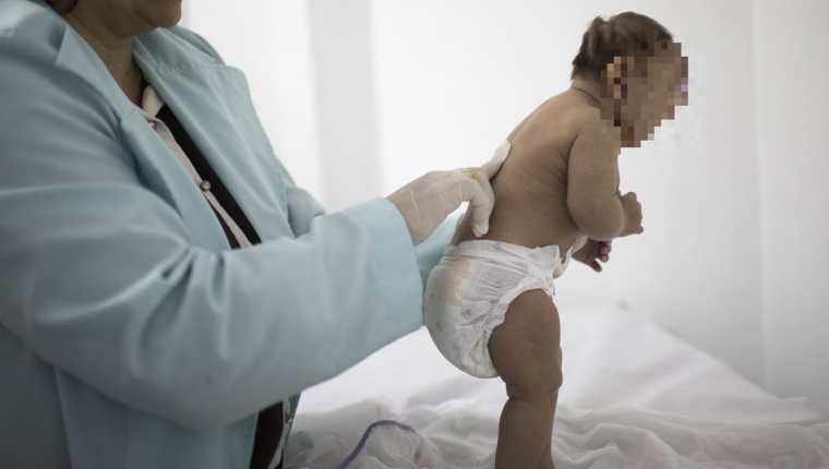 Autoridades de salud estadounidenses informaran que no hay dudas de que el virus del zika causa el nacimiento de bebés con cabezas anormalmente pequeñas. (Foto Prensa Libre: AFP).