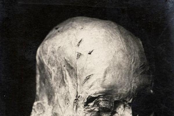 No hubo noticias de la cabeza sin corona del primer rey de la casa de Borbón de Francia hasta 1919.