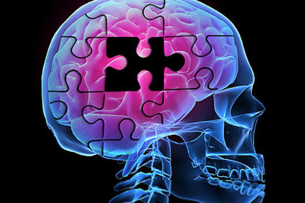 El Alzheimer es una enfermedad degenerativa que afecta a personas en edades avanzadas. <br _mce_bogus="1"/>