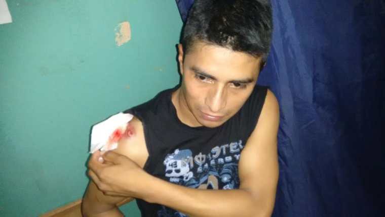 Uno de los agentes heridos en el enfrentamiento en San Andrés, Petén. (Foto Prensa Libre:PNC)