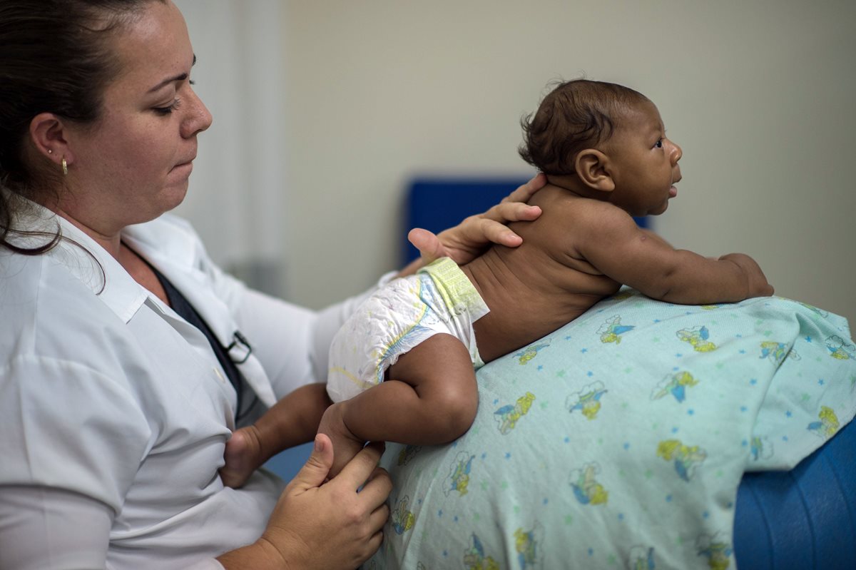 Una médica examina a un bebé con microcefalia en Brasil. (Foto Prensa Libre: AFP).