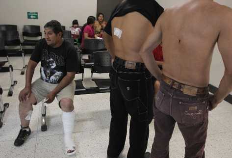 Víctimas muestran las heridas que sufrieron durante el ataque en la mina San Rafael.
