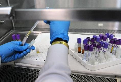 Un técnico de laboratorio trabaja con muestras de sangre de personas infectadas con el virus VIH. (Foto Prensa Libre: AFP)