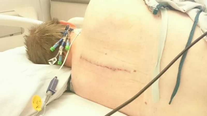 Los médicos creen que la pérdida que sufre David está en la parte de arriba de su médula espinal.