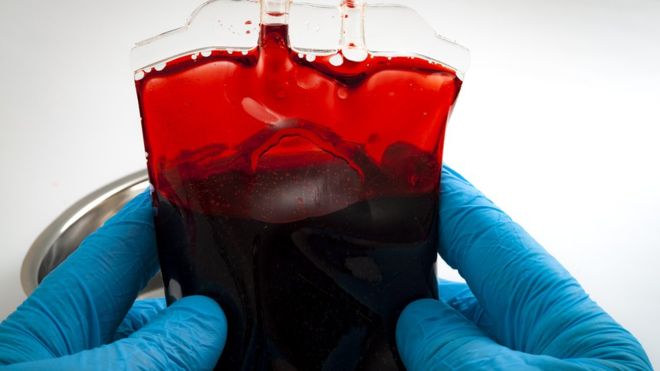 La "sangre dorada" es uno de los tipos de sangre más extraños que existen. (Foto Prensa Libre: Getty Images)