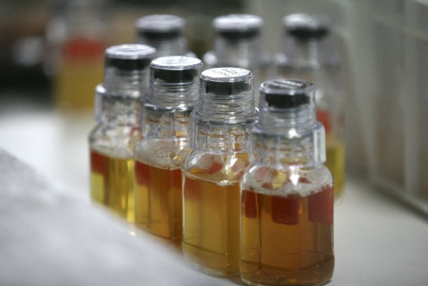 En Guatemala en los últimos 12 años se han realizado 576 pruebas, de ellas solamente 21 han sido positivas. (Foto Prensa Libre: AP)