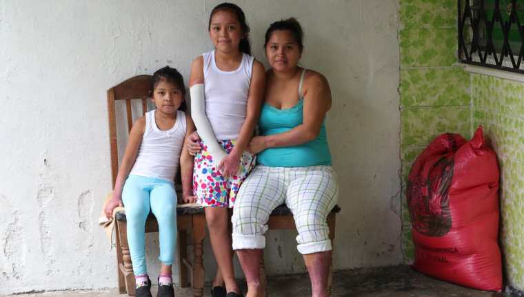 Fabiola y Kristel salieron del hospital la semana pasada. (Foto Prensa Libre: Estuardo Paredes)