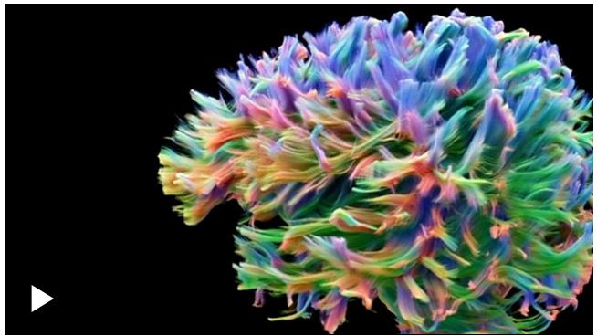 Cómo es la imagen de las conexiones cerebrales más detallada hasta el momento y para qué sirve