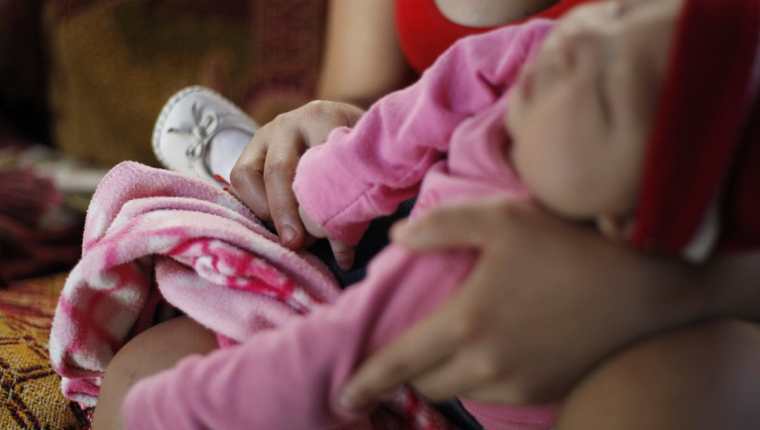 El zika en mujeres embarazadas puede causar microcefalia del bebé. (Foto Prensa Libre: Hemeroteca PL)