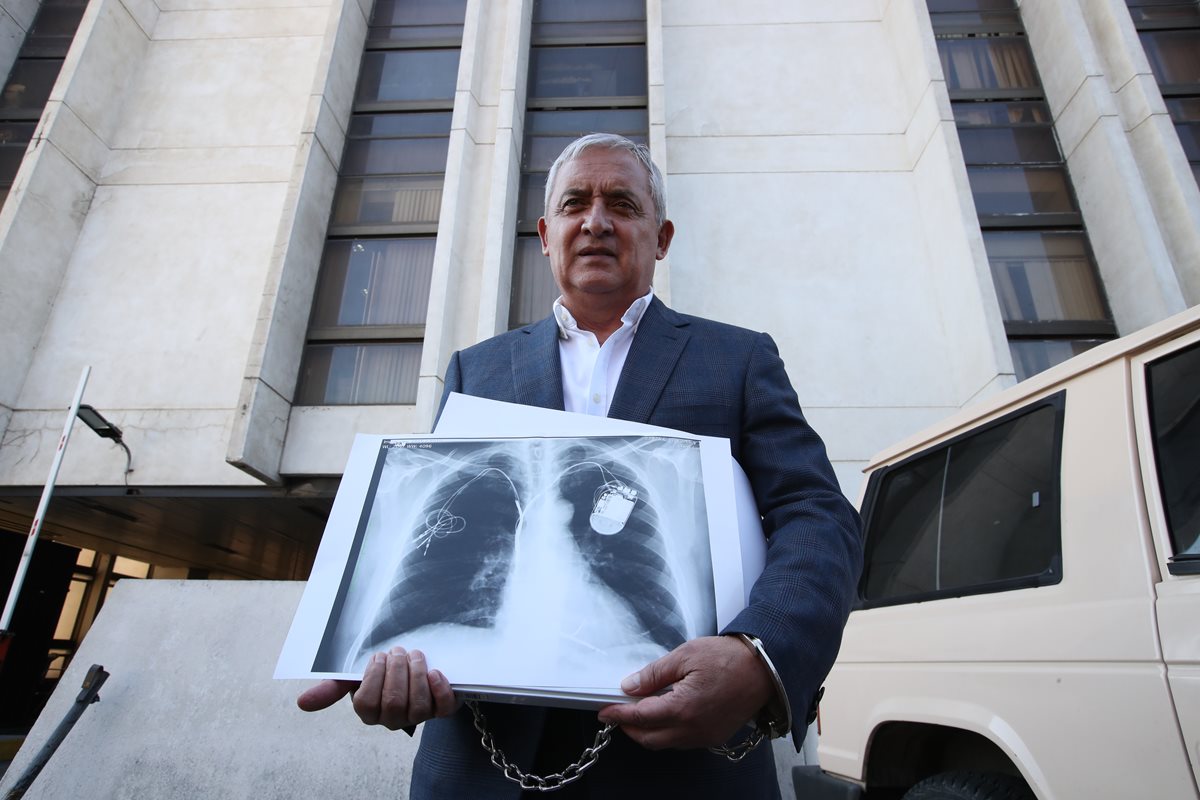 Otto Pérez Molina sostiene una radiografía, que supuestamente es de su pecho, la llevó a la audiencia con el juez Miguel Ángel Gálvez. (Foto Prensa Libre: Hemeroteca PL)