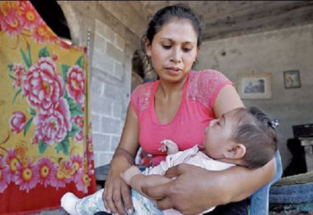 Sandy Yamileth,  a sus 6 meses de edad y a pesar de tener microcefalia, ya hace varios intentos por gatear, según sus padres.(Foto Prensa Libre: Paulo Raquec)