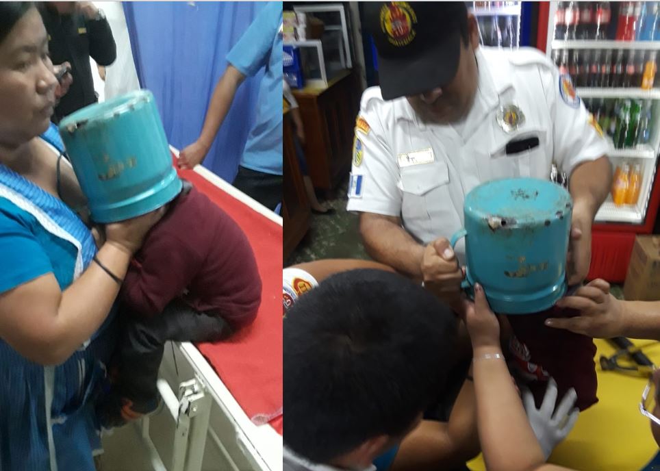 El pequeño fue llevado a la emergencia del Hospital Nacional de Chimaltenango, donde socorristas y médicos cortaron el pichel con tijeras para lámina. (Foto Prensa Libre: Cortesía Víctor Chamalé)