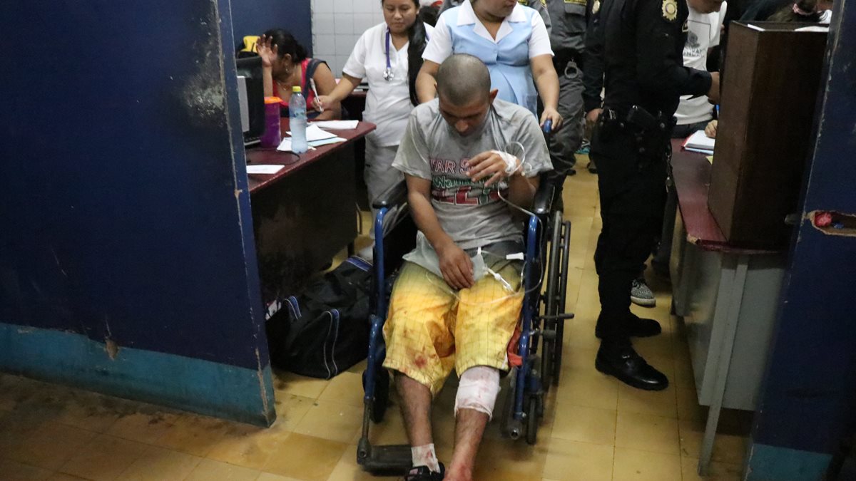 Uno de los dos reos por la explosión de una granada en la cárcel de Mazatenango, Suchitepéquez, es atendido en el hospital nacional. (Foto Prensa Libre: Cristian Soto)