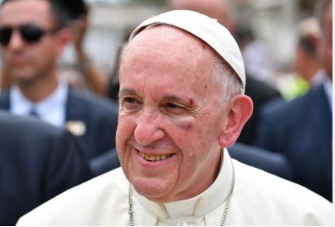 El papa Francisco resultó herido durante su vista a Cartagena de Indias, Colombia. (Foto Prensa Libre: EFE)