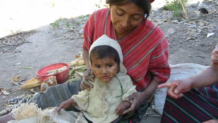 En varios municipios de Huehuetenango el Ministerio de Salud detectó que siete de cada diez niños padecen desnutrición crónica. (Foto Prensa Libre: M. Castillo)