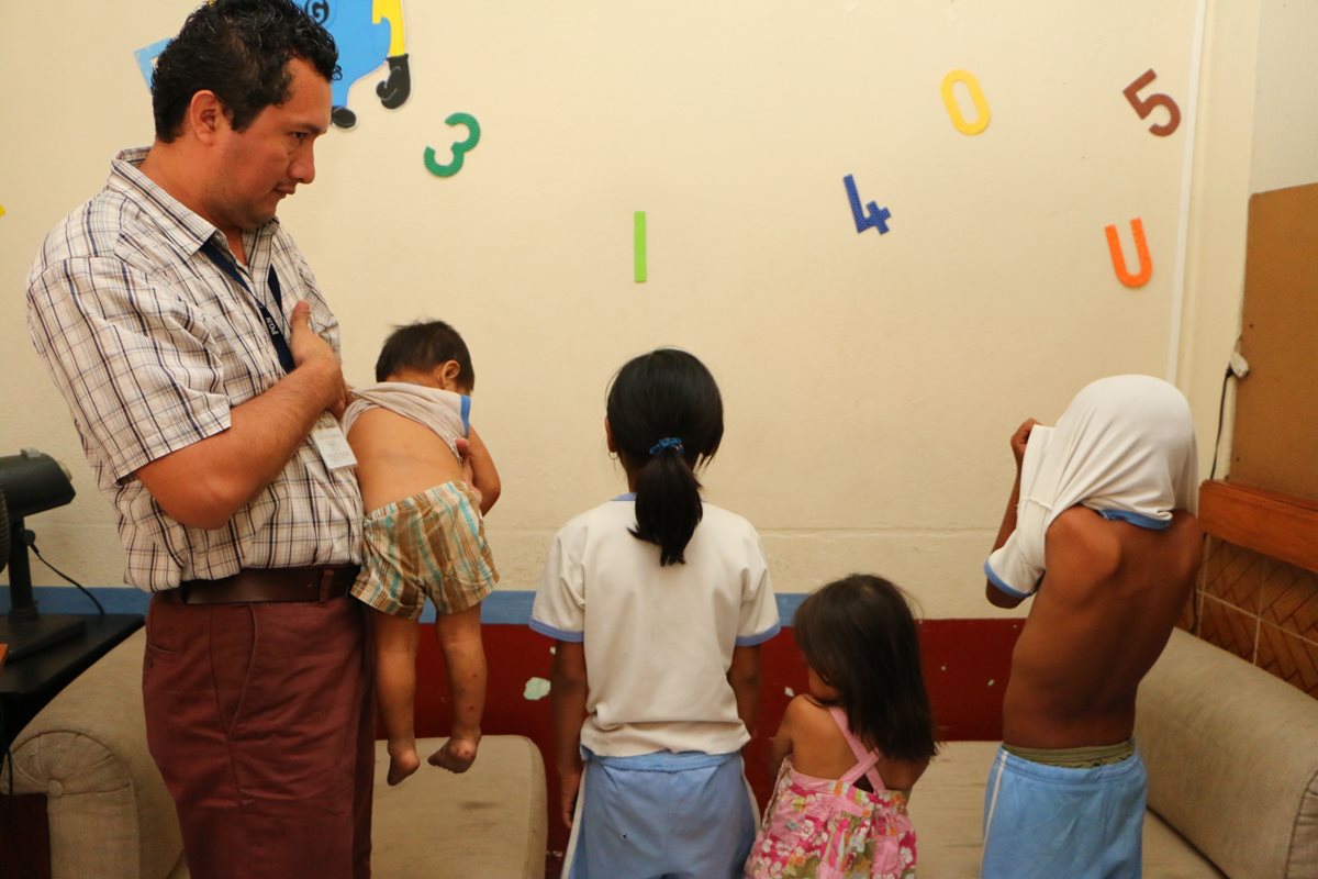 Niños rescatados en la cabecera de Retalhuleu muestran heridas ocasionadas por agresor. (Foto Prensa Libre: Rolando Miranda)