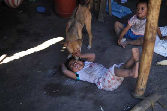 Algunos niños padecen desnutrición en los  Magueyes, en San Luis Jilotepeque, Jalapa. Esbin García.