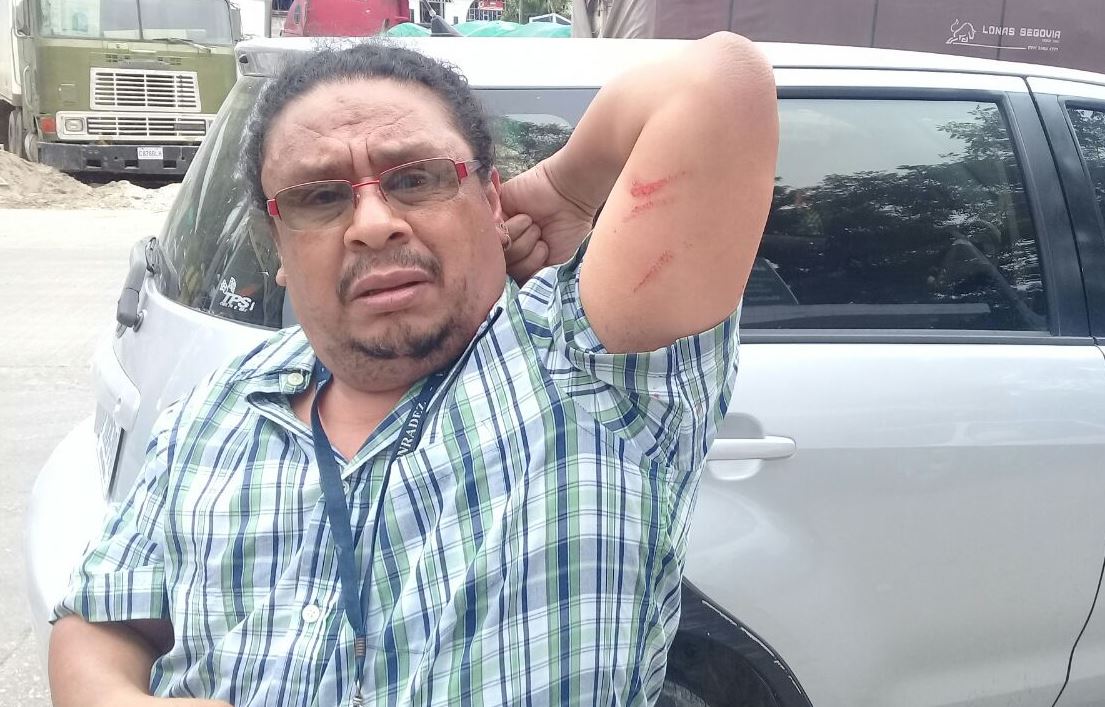 Periodista guatemalteco es agredido en zona de adyacencia entre Belice y Guatemala