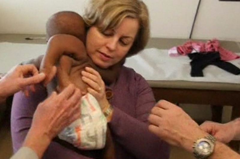 Dominique nació con un gemelo parasitario en su espala y hombro. (Foto Prensa Libre: BBC)