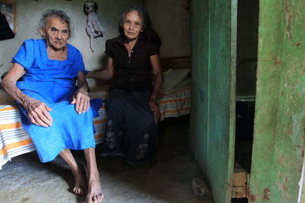 Doña Oti, quien sufrió una fractura en su pierna derecha que le impide caminar, junto a su única hija que vela por ella.(Foto Prensa Libre: Estuardo Paredes)