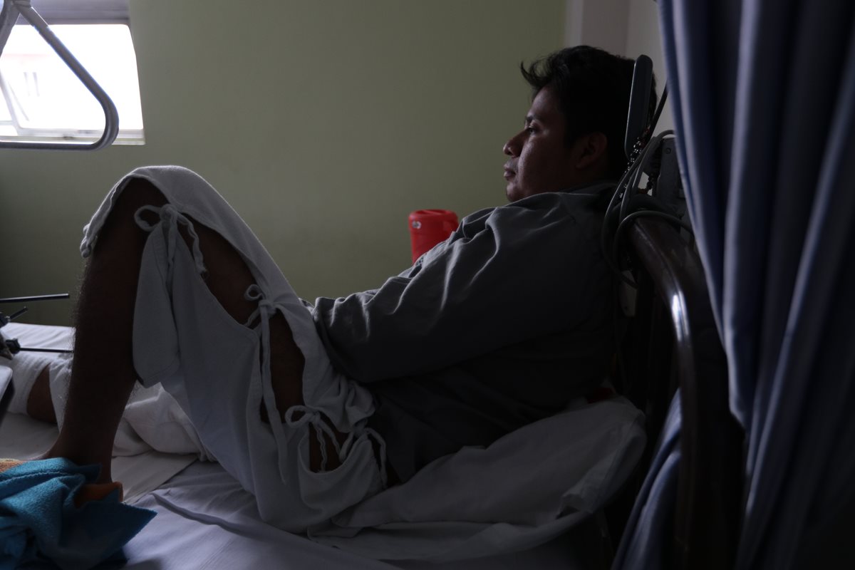 Jonnhi Contreras, espera que el tiempo pase rápido y con él su recuperación. (Foto Prensa Libre: Carlos Hernández)