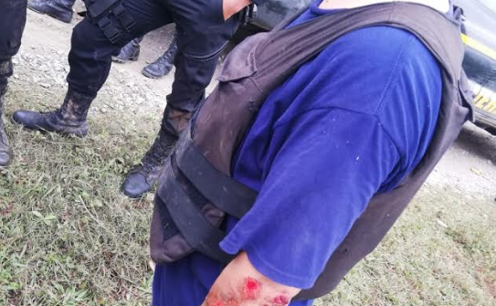 Uno de los agentes que resultó herido por la turba en Senahú, Alta Verapaz. (Foto Prensa Libre: Eduardo Sam).