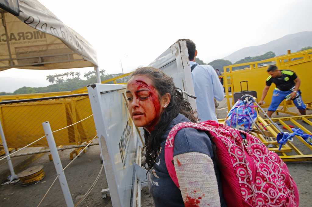 Una mujer camina después de ser herida cuando dos vehículos blindados venezolanos manejaron desde el lado venezolano del Puente Internacional Simón Bolívar hacia Colombia, derribando una valla de seguridad en Cúcuta