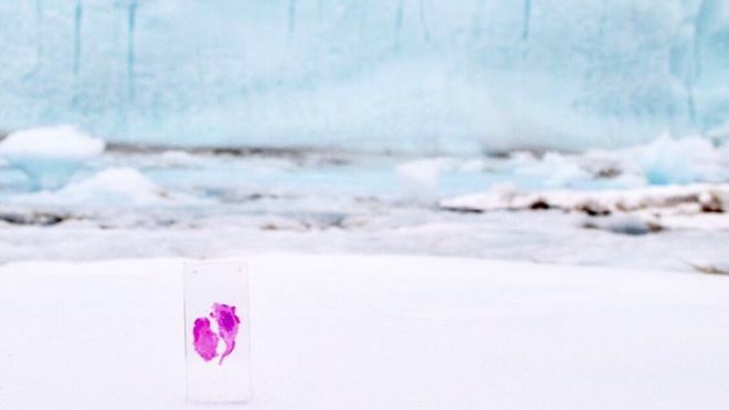 Giertz quiso mandar a la Antártida una placa con parte del tumor cerebral que le extrajeron. (Foto Prensa Libre: Ariel Waldman)