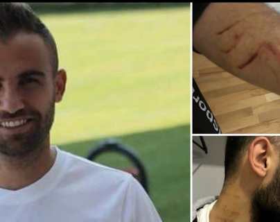 Violencia en el futbol, un jugador turco es acusado de agredir a varios rivales con una cuchilla