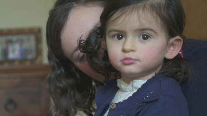 Sólo 500 personas en el mundo padecen la condición de Anya. (Foto Prensa Libre: BBC)