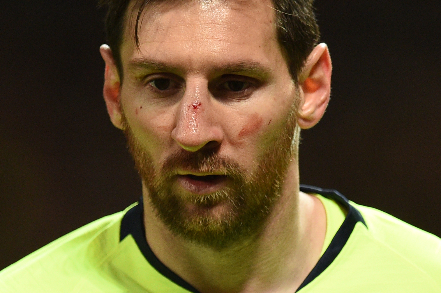 La mirada de perdida de Lionel Messi después de recibir un golpe en el rostro. (Foto Prensa Libre: AFP)
