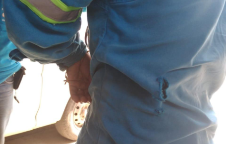 Uno de los trabajadores de Energuate que fue atacado con machete en Guasitepeque, Gualán, Zacapa. (Foto Prensa Libre: Cortesía).