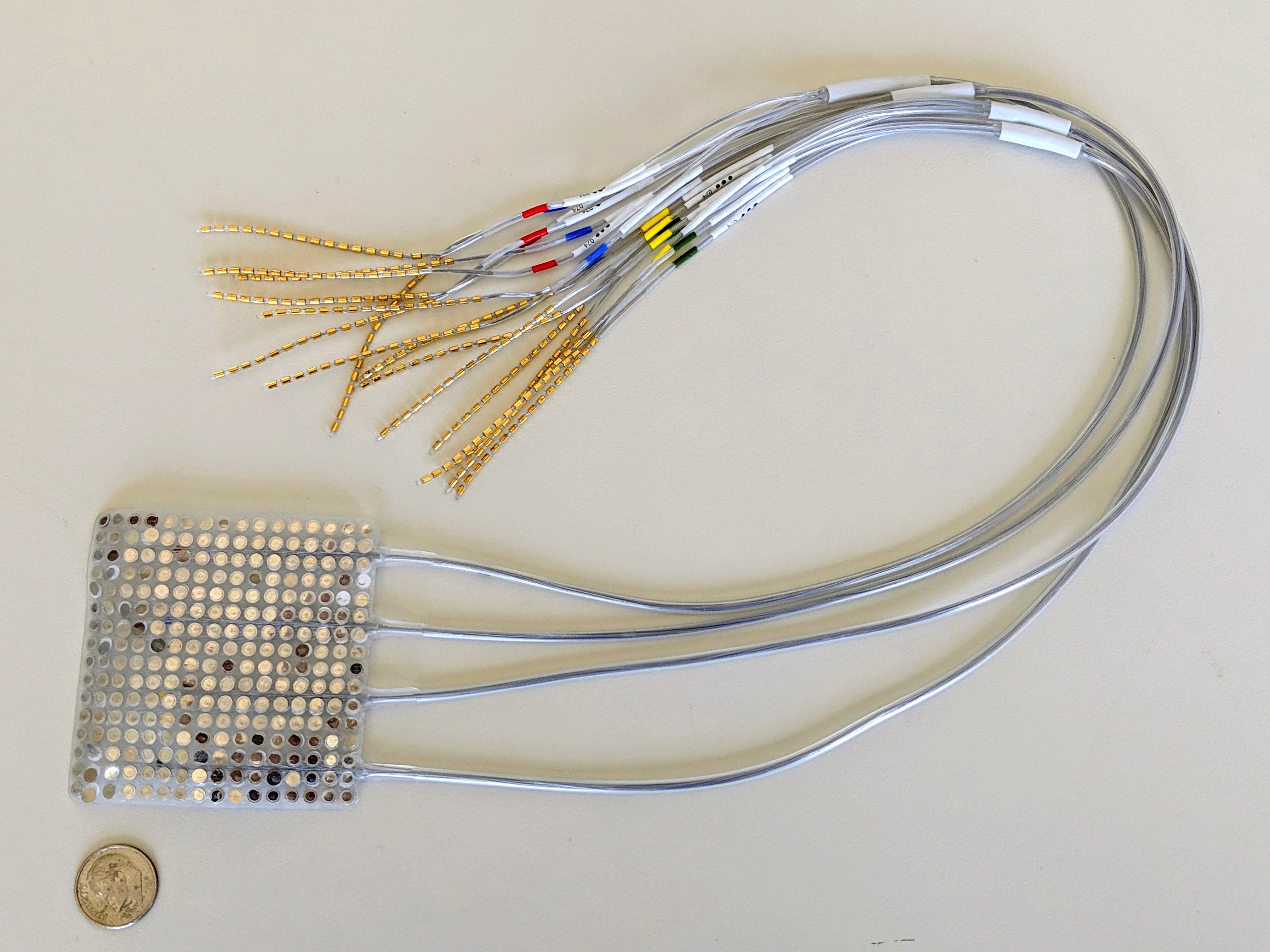 Un estudio publicado por la revista Nature habla de este dispositivo para mejorar la comunicación de personas con ciertas condiciones neurológicas. (Foto Prensa Libre: EFE/Nature) 