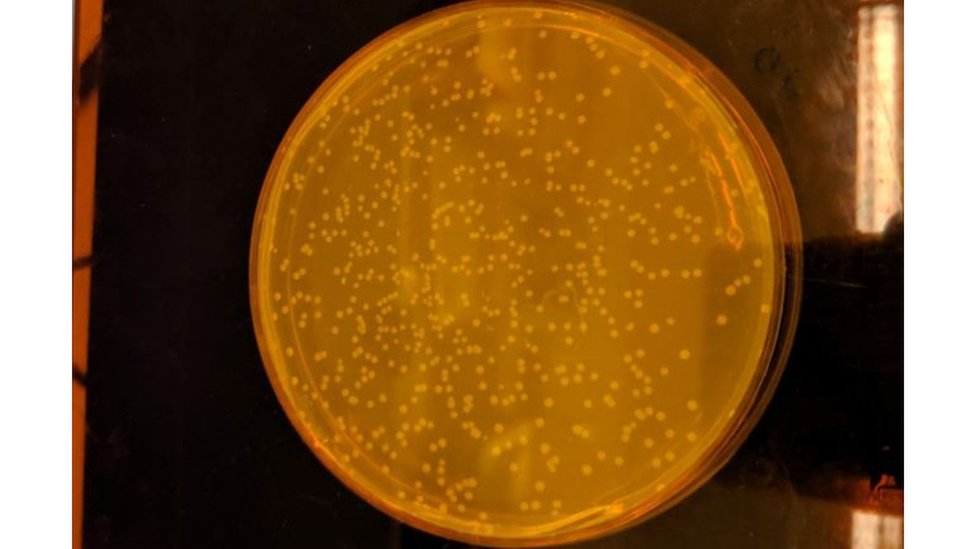 La bacteria, denominada Syn61, es una versión artificial de la bacteria E. coli que vive en el intestino. (Foto Prensa Libre: Jason Chin)
