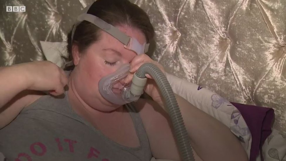 Kelly Knipes duerme con una máscara de oxígeno que se asegura de que respira por las noches. (Foto Prensa Libre: BBC)