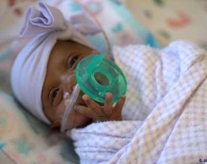 El bebé más pequeño del mundo nació en EE. UU.: pesó lo mismo que una manzana