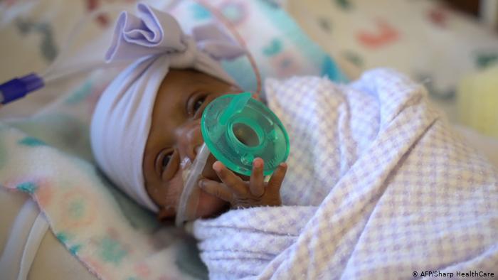  Una niña que al nacer pesó 245 gramos -equivalente a una manzana grande- se convirtió en el bebé más pequeño del mundo, informó el miércoles un hospital de Estados Unidos. Fue dada de alta este jueves.