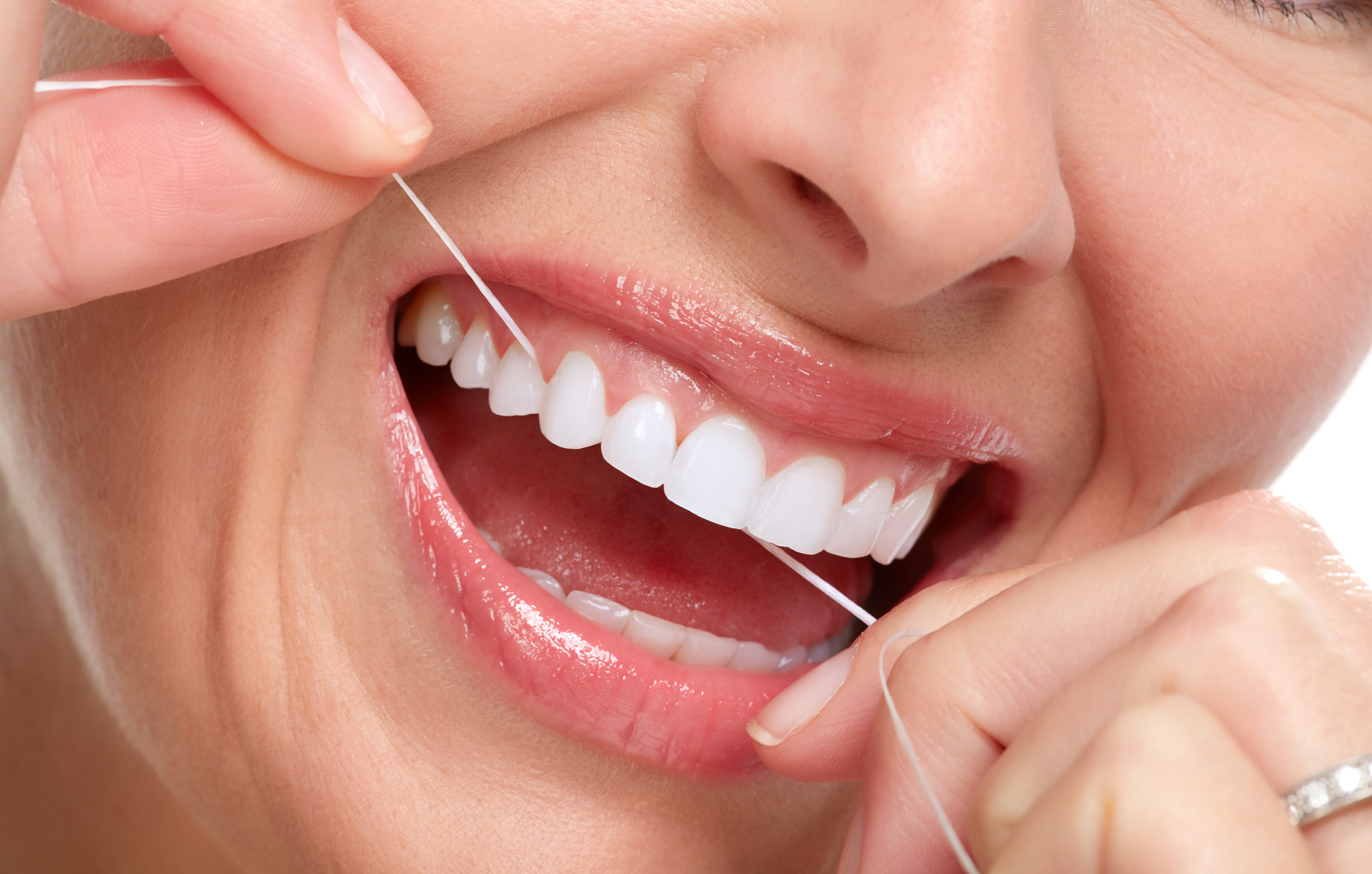 El uso regular del hilo dental remueve la placa. Además, también ayuda a prevenir la caries y reducir el riesgo de desarrollar enfermedad de las encías. (Foto Prensa Libre: Shutterstock)