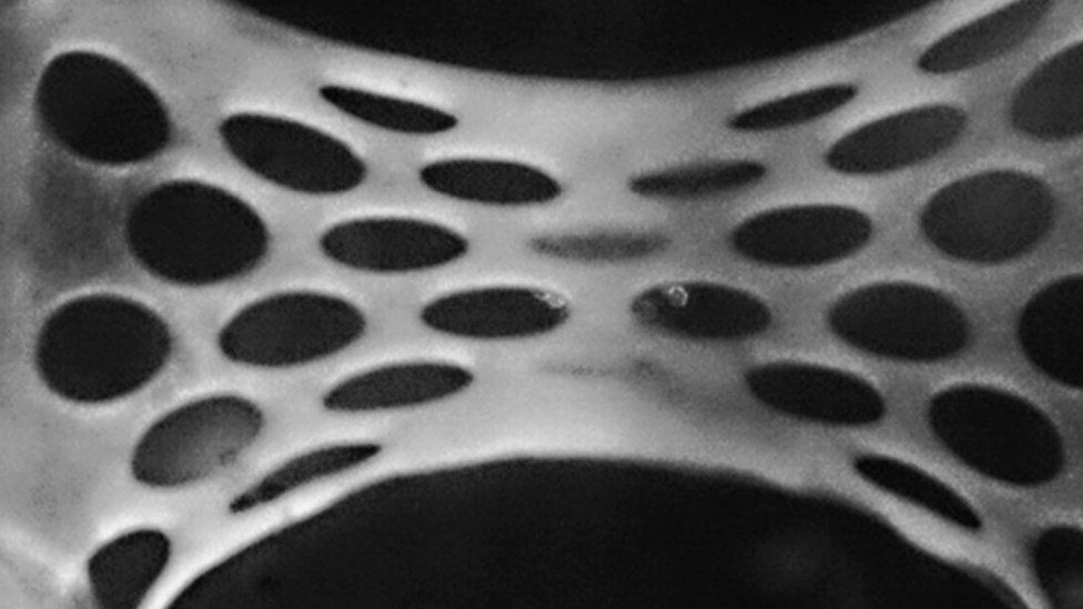 El parche fue desarrollado a partir de hasta 50 millones de células madre reprogramadas para transformarse en células de músculo cardíaco. (Foto Prensa Libre: Sian Harding Imperial College)