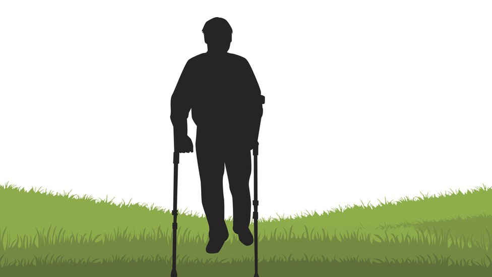 El síndrome de Werner hace que el cuerpo envejezca demasiado rápido. (Foto Prensa Libre: Getty Images)