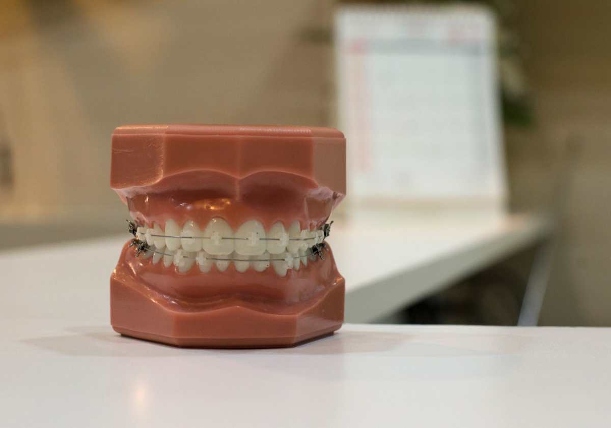 Seis cuidados dentales para las personas que usan brackets