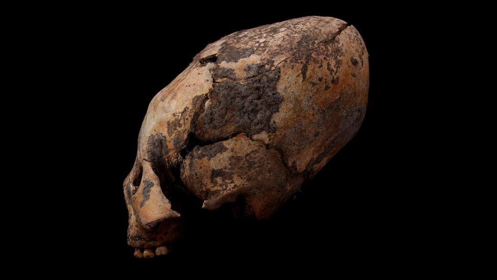 Los impresionantes cráneos humanos deformados intencionalmente en China hace 12.000 años (y qué pistas le brindan a la ciencia)