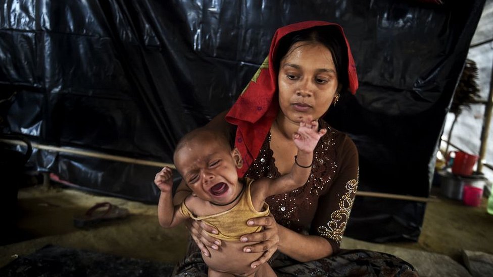 La desnutrición es un problema que afecta a más de 150 millones de niños en todo el mundo, según la OMS. (Foto Prensa Libre: Getty Images)
