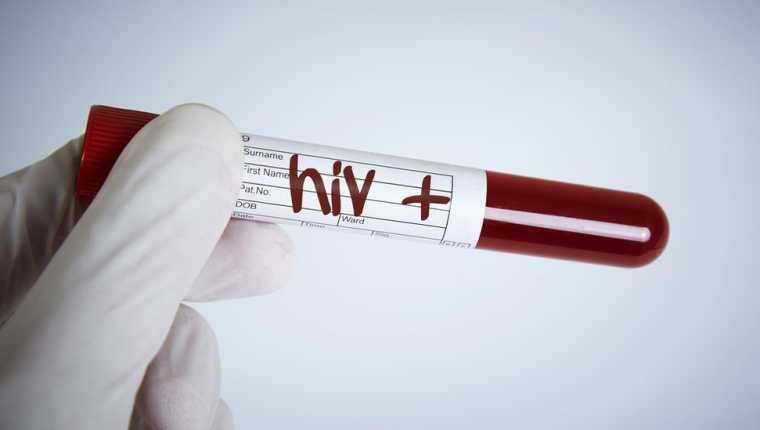 La ONU sigue trabajando para erradicar el VIH (o HIV, en inglés).