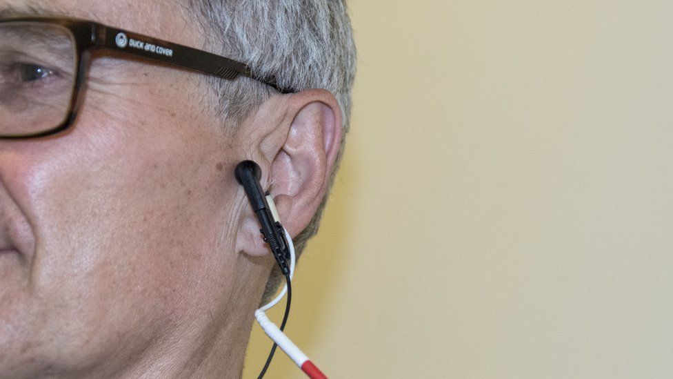 La estimulación del nervio vago se hizo durante 15 minutos al día por dos semanas. (Foto Prensa Libre: Universidad de Leeds)